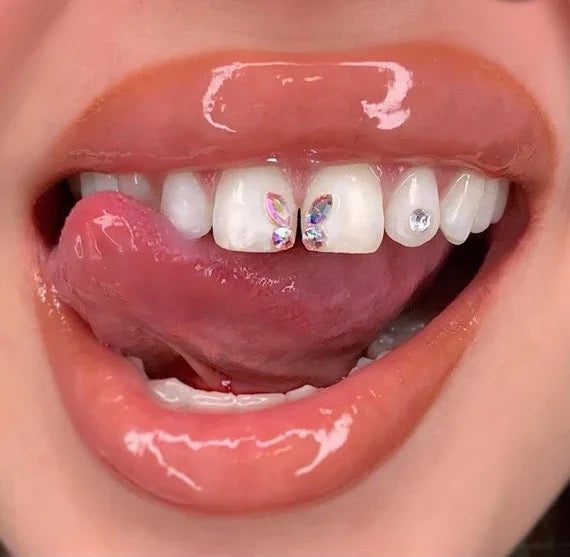 Tooth Jewelry, Tooth Gems, Dental Jewelry Diamonds - Twinkles